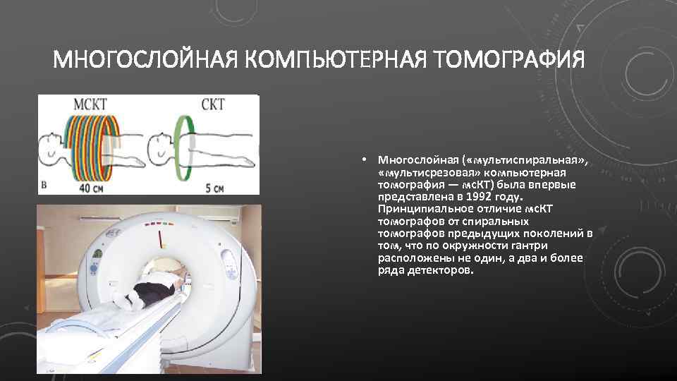 Компьютерная томография определяет