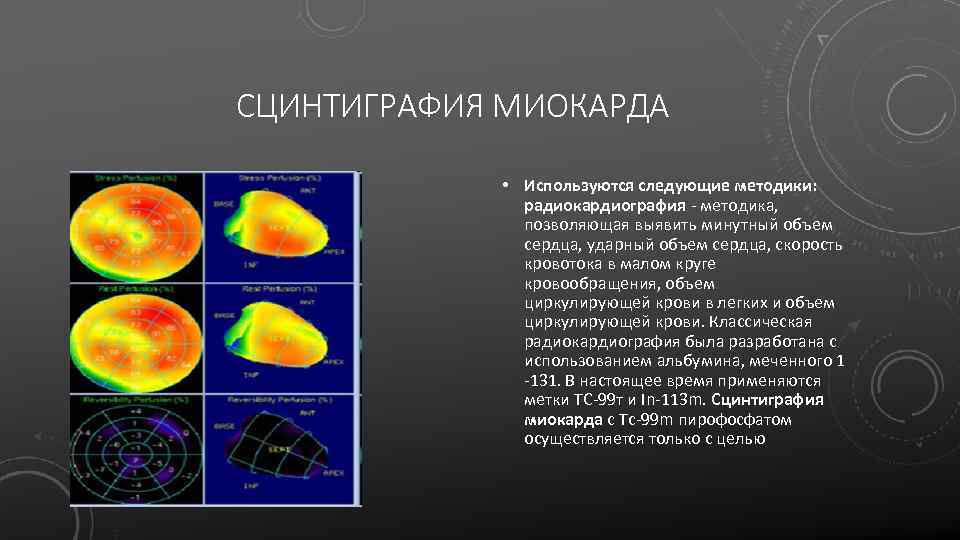 СЦИНТИГРАФИЯ МИОКАРДА • Используются следующие методики: радиокардиография - методика, позволяющая выявить минутный объем сердца,