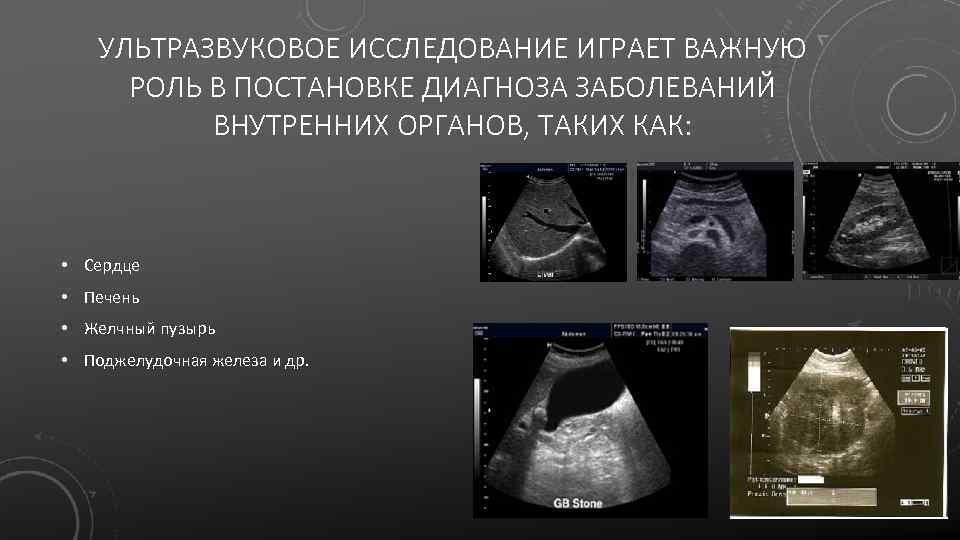 УЛЬТРАЗВУКОВОЕ ИССЛЕДОВАНИЕ ИГРАЕТ ВАЖНУЮ РОЛЬ В ПОСТАНОВКЕ ДИАГНОЗА ЗАБОЛЕВАНИЙ ВНУТРЕННИХ ОРГАНОВ, ТАКИХ КАК: •