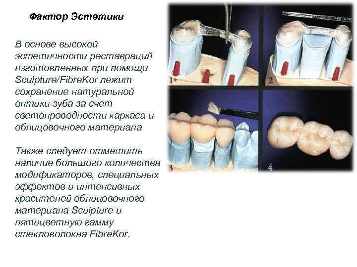Фактор Эстетики В основе высокой эстетичности реставраций изготовленных при помощи Sculpture/Fibre. Kor лежит сохранение