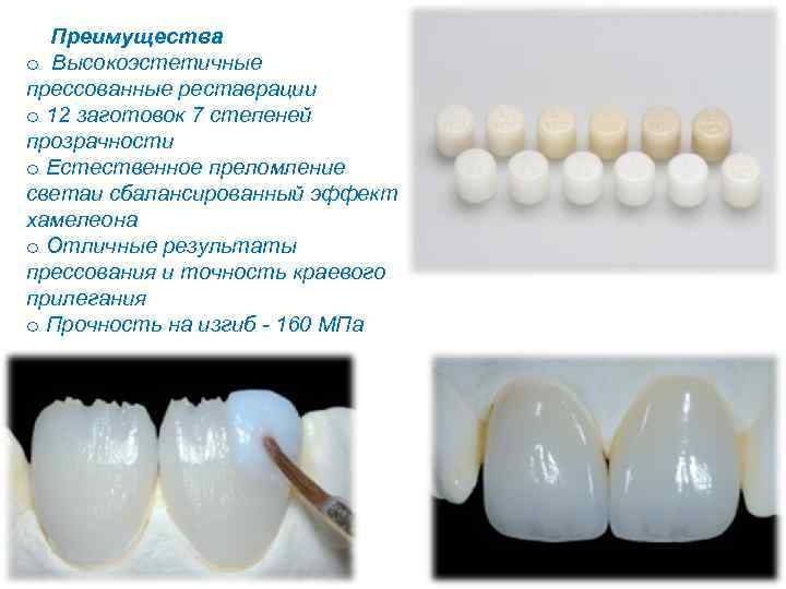 Виды реставрации. Безметалловая керамика презентация. Высокоэстетичная безметалловая керамика. Толщина безметалловой керамической коронки. Безметалловая керамика на живые зубы.