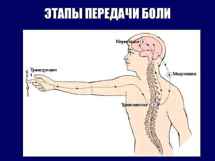 Передача больно. Механизм передачи боли. Боль этапы передачи. Схема передачи боли.