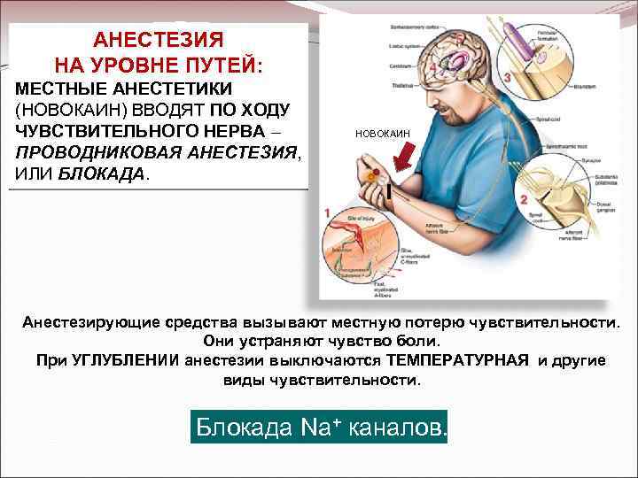 АНЕСТЕЗИЯ НА УРОВНЕ ПУТЕЙ: МЕСТНЫЕ АНЕСТЕТИКИ (НОВОКАИН) ВВОДЯТ ПО ХОДУ ЧУВСТВИТЕЛЬНОГО НЕРВА – ПРОВОДНИКОВАЯ