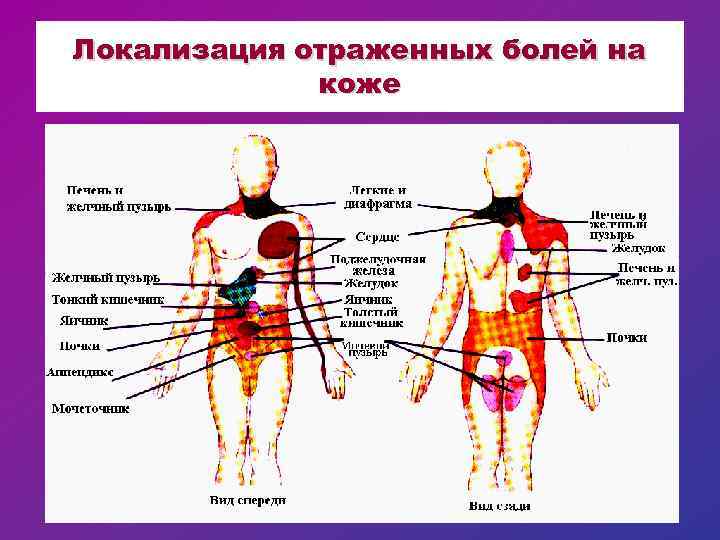 Локализация отраженных болей на коже 