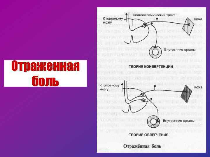 Конспекты лекции физиология. Схема возникновения отраженной боли. Механизм отраженной боли. Отраженная боль физиология. Отражающая боль.