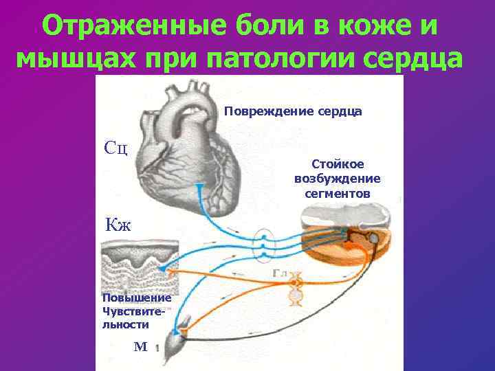 Уровни сердца. Отраженные боли. Отраженная боль возникает при. Отраженные боли пример. Отраженные боли задачи.