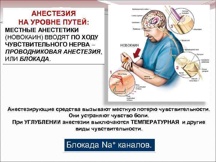 АНЕСТЕЗИЯ НА УРОВНЕ ПУТЕЙ: МЕСТНЫЕ АНЕСТЕТИКИ (НОВОКАИН) ВВОДЯТ ПО ХОДУ ЧУВСТВИТЕЛЬНОГО НЕРВА – ПРОВОДНИКОВАЯ