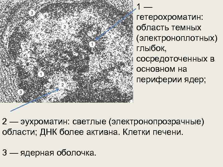 1 — гетерохроматин: область темных (электроноплотных) глыбок, сосредоточенных в основном на периферии ядер; 2