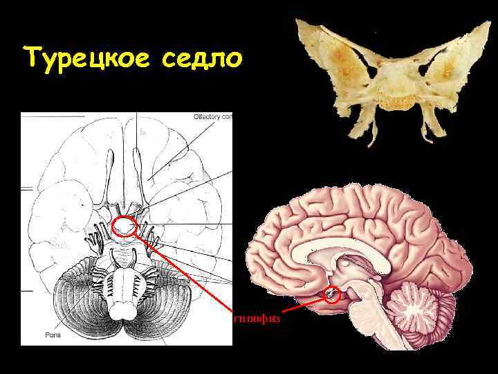 Гипофиз седло. Анатомия турецкого седла в головном мозге. Клиновидная кость черепа турецкое седло. Гипофиз в турецком седле. Турецкое седло анатомия.