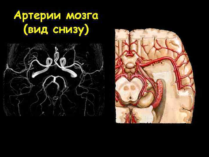 Артерии мозга (вид снизу) 