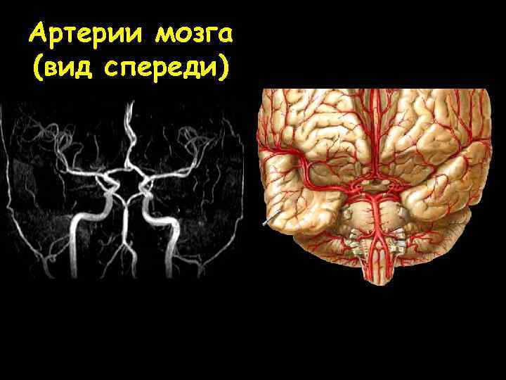 Артерии мозга (вид спереди) 