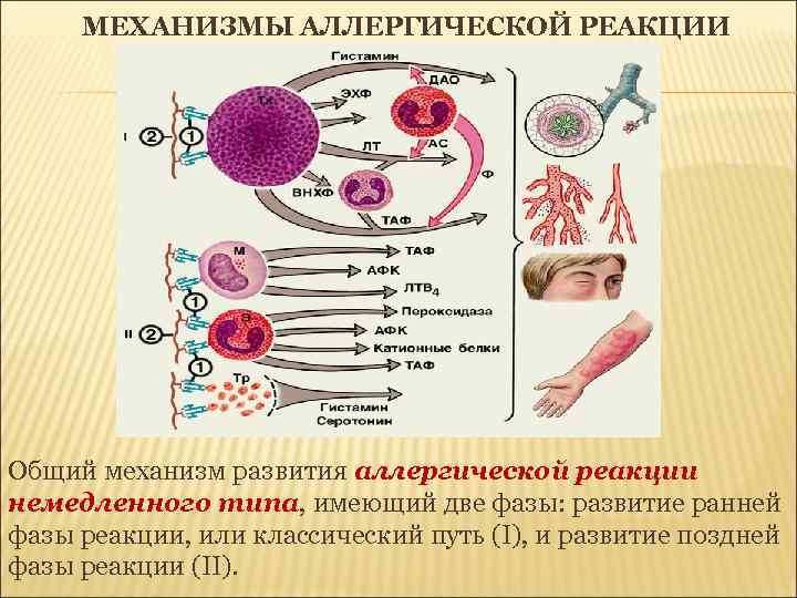 МЕХАНИЗМЫ АЛЛЕРГИЧЕСКОЙ РЕАКЦИИ Общий механизм развития аллергической реакции немедленного типа, имеющий две фазы: развитие