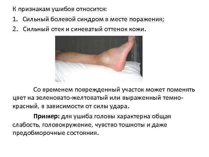 К признакам ушибов относится: 1. Сильный болевой синдром в месте поражения; 2. Сильный отек