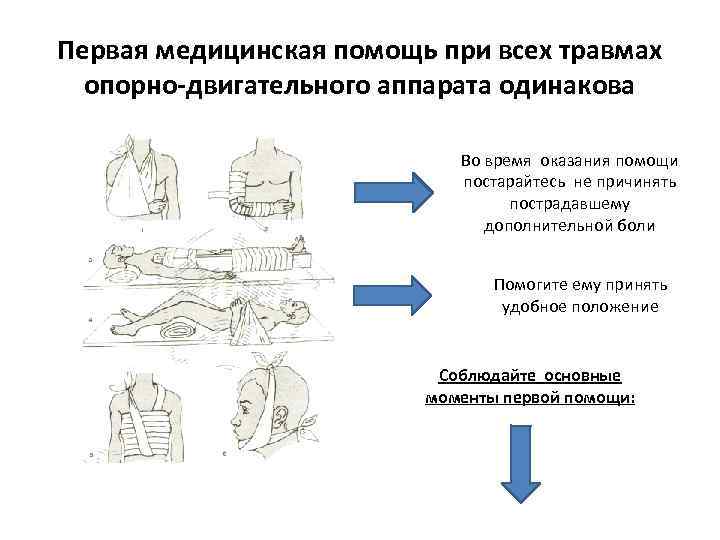 Первая медицинская помощь при всех травмах опорно-двигательного аппарата одинакова Во время оказания помощи постарайтесь