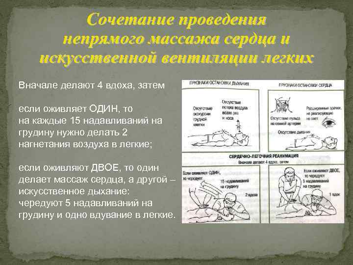 Сочетание проведения непрямого массажа сердца и искусственной вентиляции легких Вначале делают 4 вдоха, затем