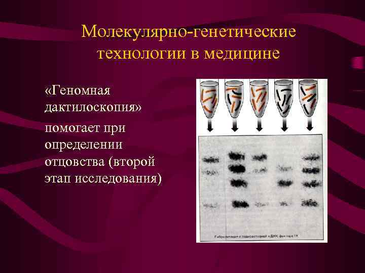 Молекулярно-генетические технологии в медицине «Геномная дактилоскопия» помогает при определении отцовства (второй этап исследования) 