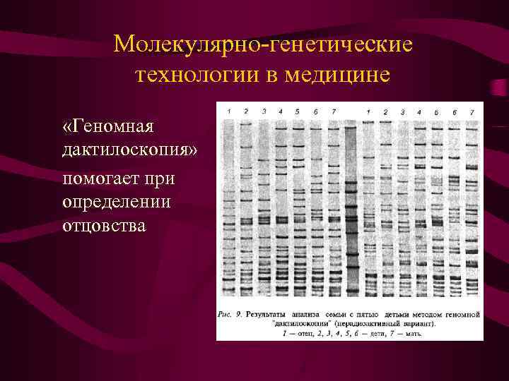 Молекулярно-генетические технологии в медицине «Геномная дактилоскопия» помогает при определении отцовства 