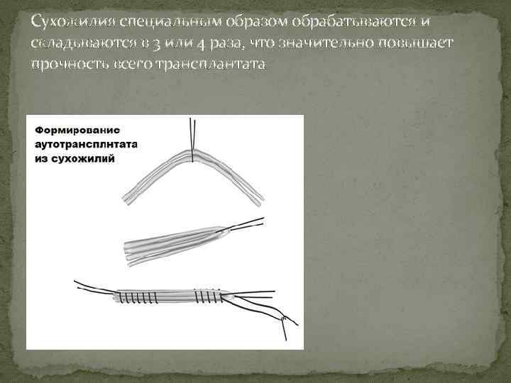 Сухожилия специальным образом обрабатываются и складываются в 3 или 4 раза, что значительно повышает