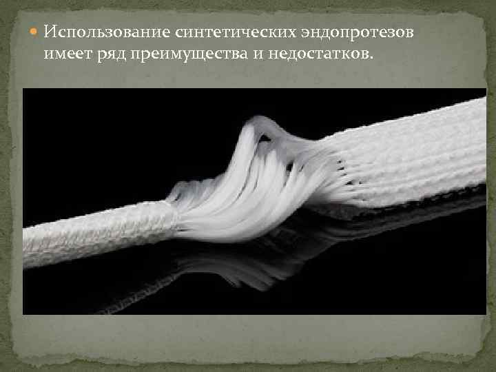  Использование синтетических эндопротезов имеет ряд преимущества и недостатков. 
