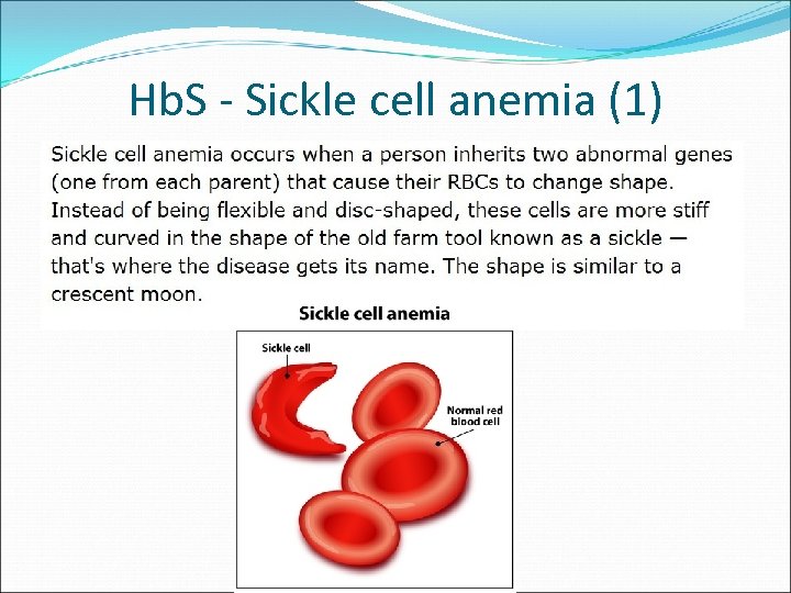 Hb. S - Sickle cell anemia (1) 