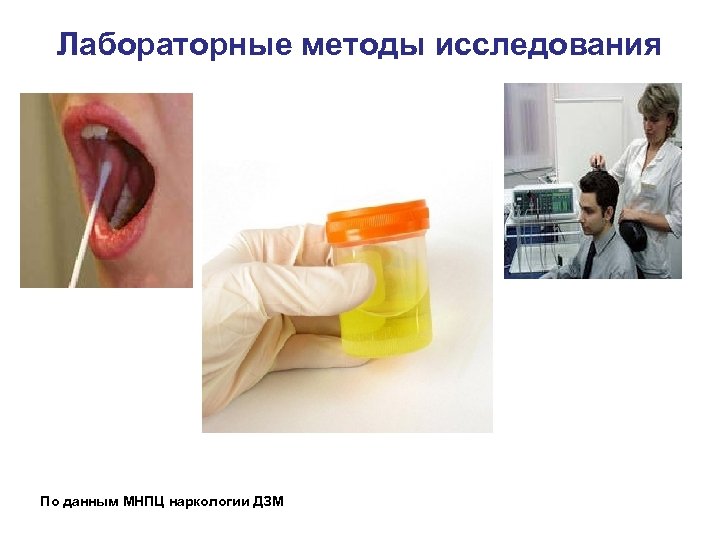 Лабораторные методы исследования По данным МНПЦ наркологии ДЗМ 