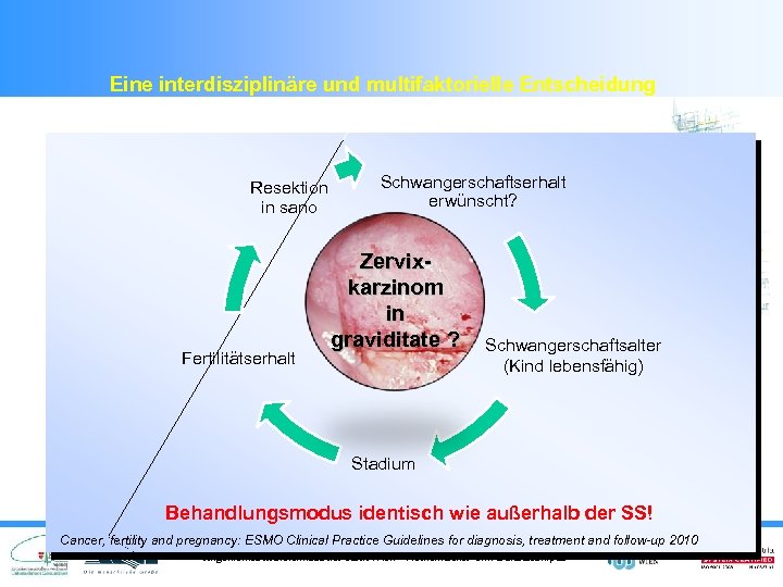 Eine interdisziplinäre und multifaktorielle Entscheidung Resektion in sano Fertilitätserhalt Schwangerschaftserhalt erwünscht? Zervixkarzinom in graviditate