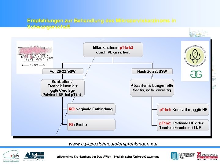 Empfehlungen zur Behandlung des Mikrozervixkarzinoms in Schwangerschaft Mikrokarzinom p. T 1 a 1/2 durch