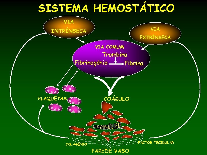 SISTEMA HEMOSTÁTICO VIA INTRÍNSECA EXTRÍNSECA VIA COMUM Trombina Fibrinogénio Fibrina PLAQUETAS COÁGULO FACTOR TECIDULAR