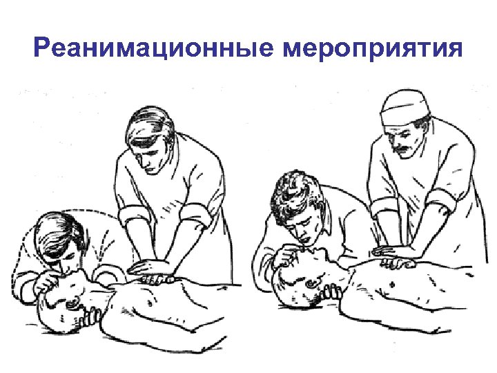 Реанимационные мероприятия 