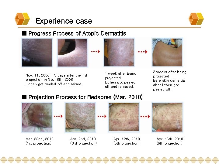 Experience case ■ Progress Process of Atopic Dermatitis Nov. 11, 2008 - 3 days
