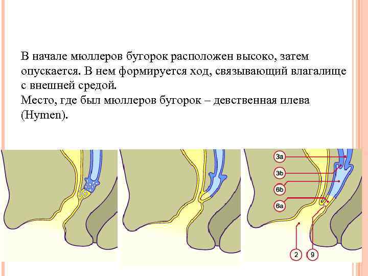 В начале мюллеров бугорок расположен высоко, затем опускается. В нем формируется ход, связывающий влагалище