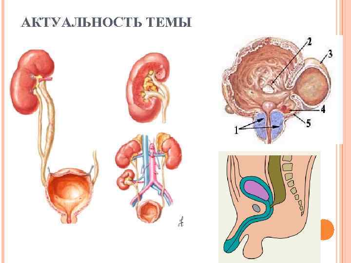 АКТУАЛЬНОСТЬ ТЕМЫ 