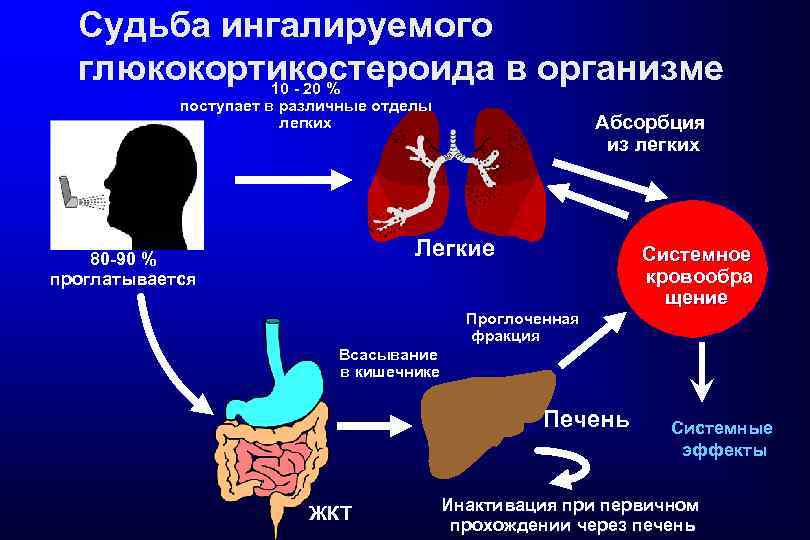 Судьба ингалируемого глюкокортико% стероида в организме 10 - 20 поступает в различные отделы легких