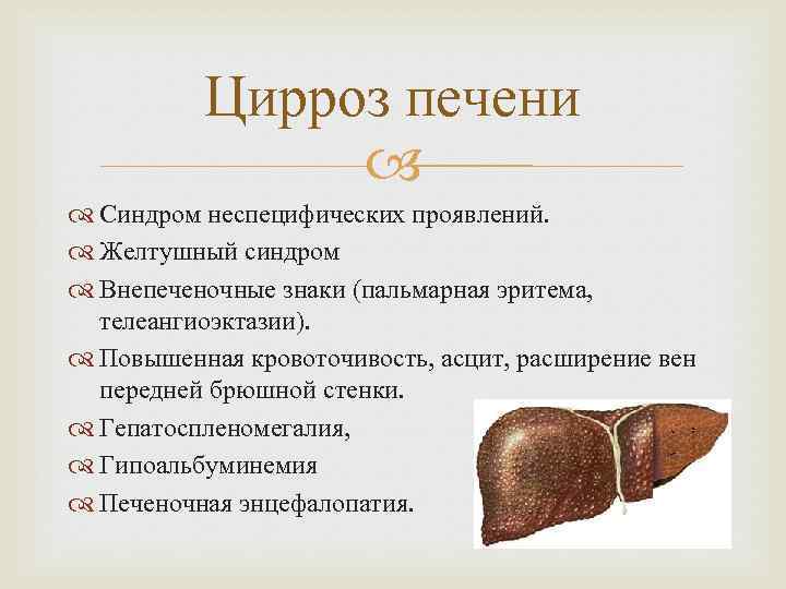 Цирроз печени Синдром неспецифических проявлений. Желтушный синдром Внепеченочные знаки (пальмарная эритема, телеангиоэктазии). Повышенная кровоточивость,