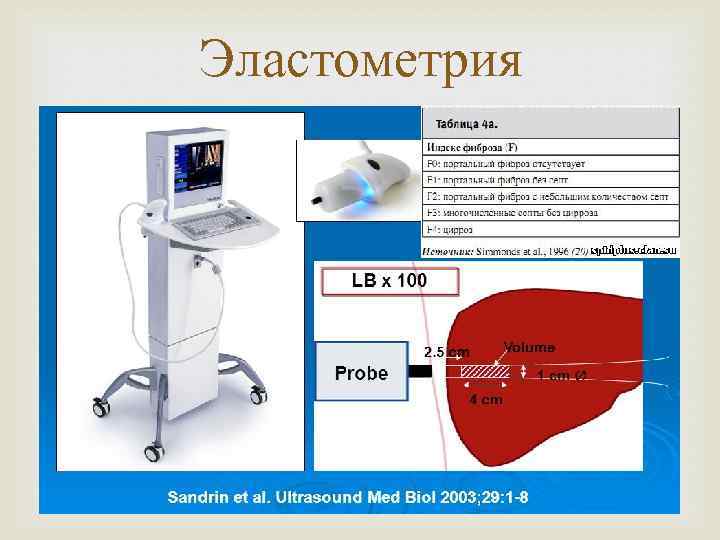 Эластометрия 