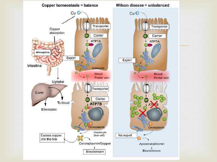 Болезнь Вильсона. Коновалова 