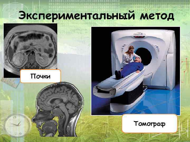 Экспериментальный метод Почки Томограф 