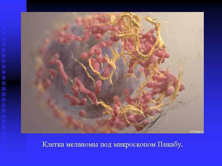 Клетка меланомы под микроскопом Пикабу. 