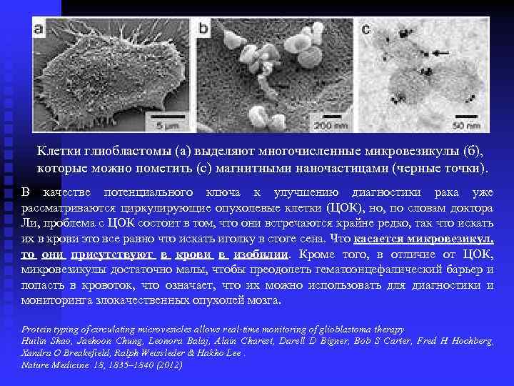 Клетки глиобластомы (а) выделяют многочисленные микровезикулы (б), которые можно пометить (с) магнитными наночастицами (черные