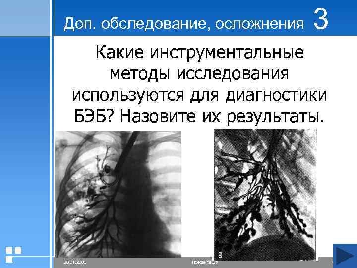 Доп. обследование, осложнения 3 Какие инструментальные методы исследования используются для диагностики БЭБ? Назовите их