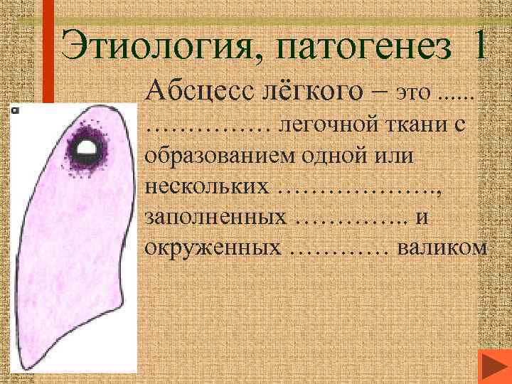 Этиология, патогенез 1 Абсцесс лёгкого – это. . . …………… легочной ткани с образованием