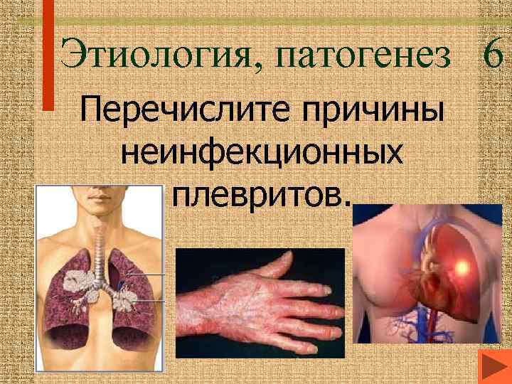 Этиология, патогенез 6 Перечислите причины неинфекционных плевритов. 