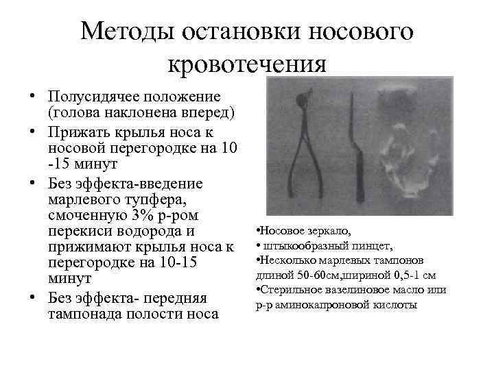 Методы остановки носового кровотечения • Полусидячее положение (голова наклонена вперед) • Прижать крылья носа