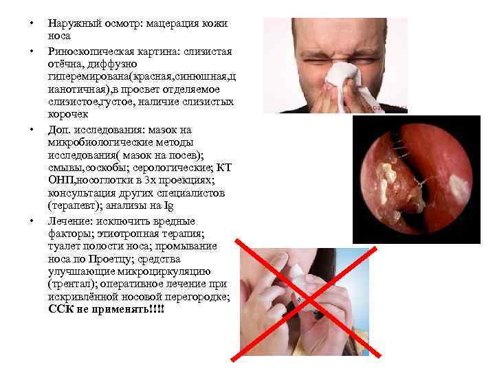  • • Наружный осмотр: мацерация кожи носа Риноскопическая картина: слизистая отёчна, диффузно гиперемирована(красная,