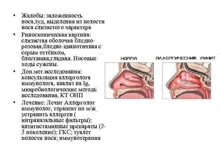  • Жалобы: заложенность носа, зуд, выделения из полости носа слизистого характера • Риноскопическая