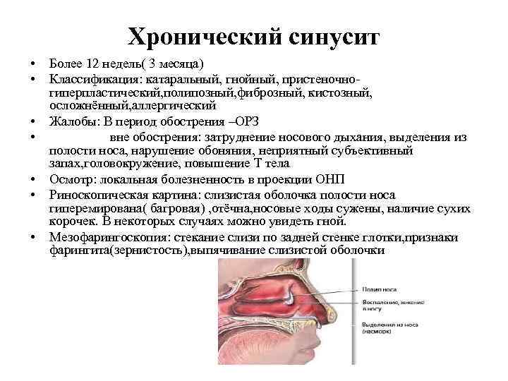 Хронический синусит • • Более 12 недель( 3 месяца) Классификация: катаральный, гнойный, пристеночно гиперпластический,