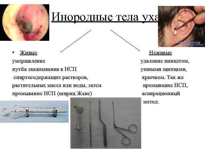 Инородное тело уха карта вызова