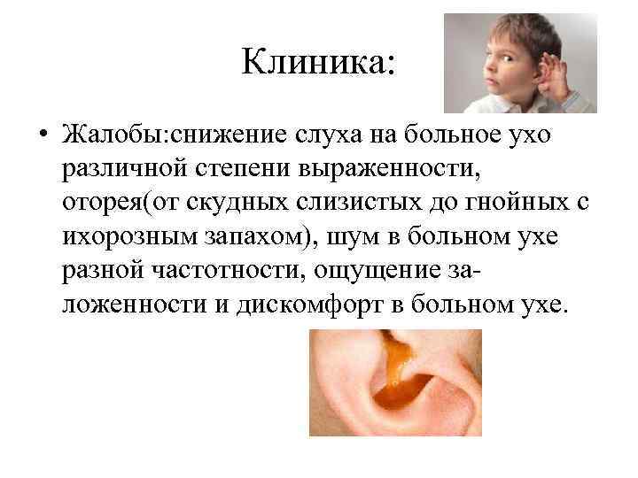 Клиника: • Жалобы: снижение слуха на больное ухо различной степени выраженности, оторея(от скудных слизистых