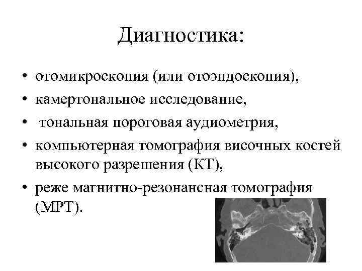 Диагностика: • • отомикроскопия (или отоэндоскопия), камертональное исследование, тональная пороговая аудиометрия, компьютерная томография височных