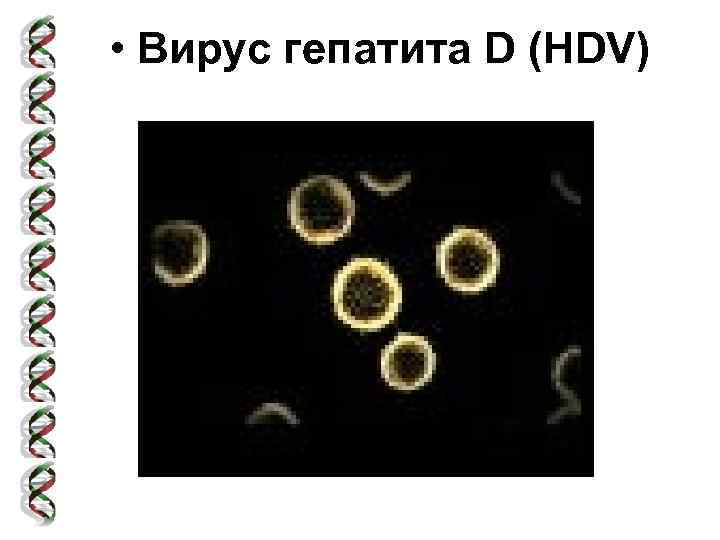  • Вирус гепатита D (HDV) 
